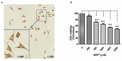 Mitochondrial Effects of PGC-1alpha Silencing in MPP+ Treated Human SH-SY5Y Neuroblastoma Cells